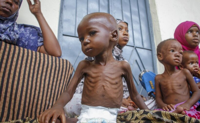 U Somaliji masovno umiru deca zbog gladi koju je izazvala suša, najveća u poslednjih 40 godina. Predstavnici somalijske vlade