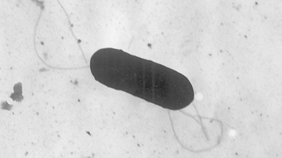 smrtonosna-infekcija-listerijom